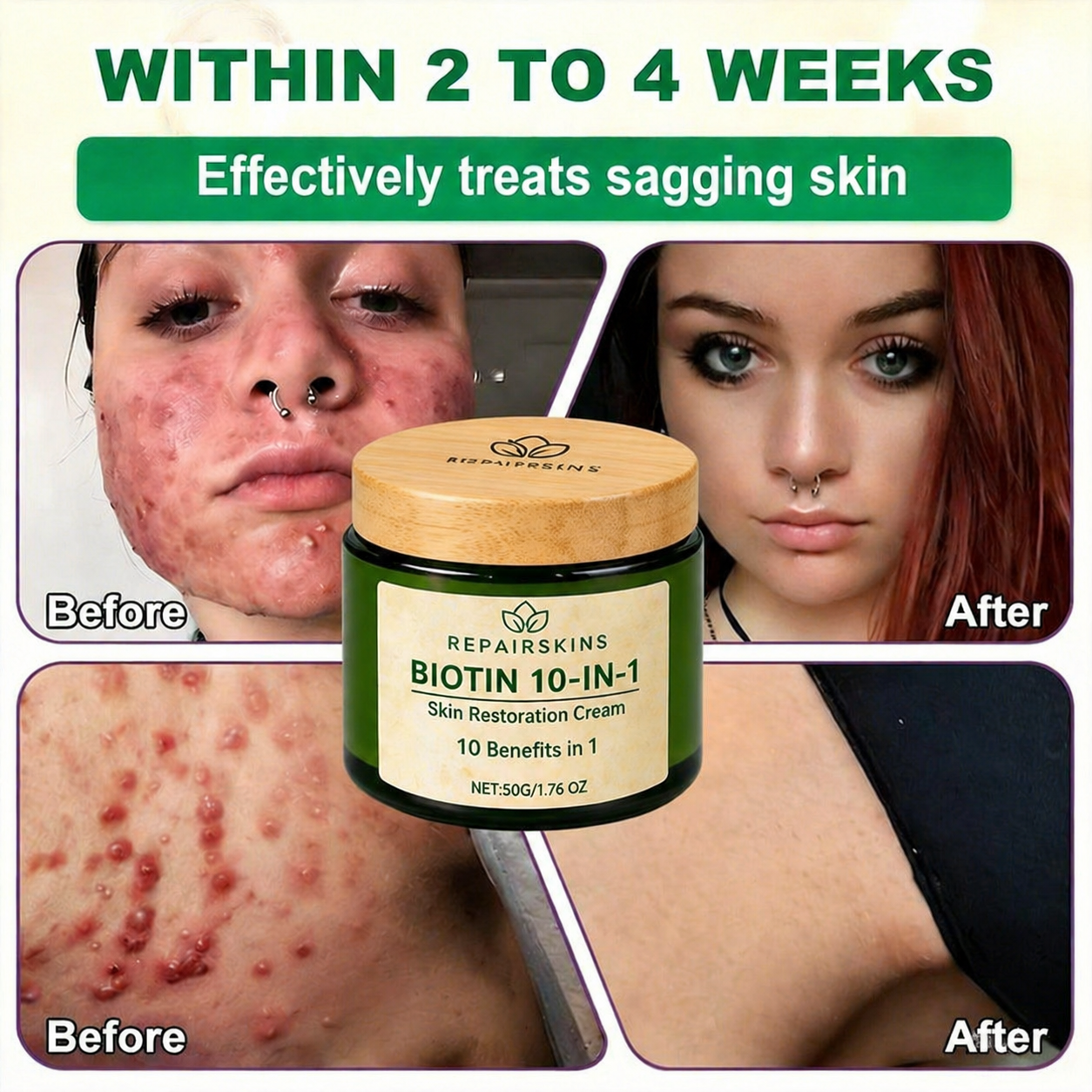 Made and Shipped from USA ✨REPAIRSKINS® Biotin 10-in-1 Skin Restoration Cream 🍀