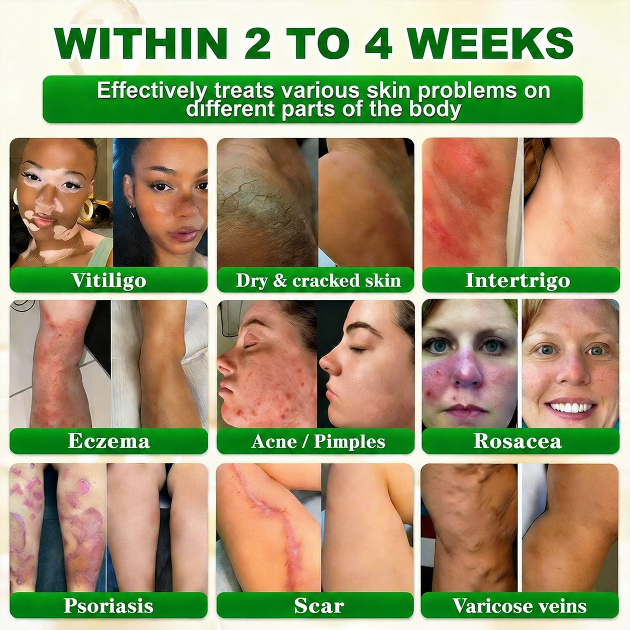 Made and Shipped from USA ✨REPAIRSKINS® Biotin 10-in-1 Skin Restoration Cream 🍀