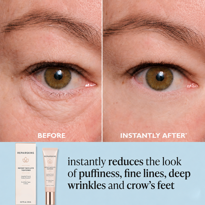 REPAIRSKINS Instant Face Temporary Tightener – Instant visible results in 60 seconds