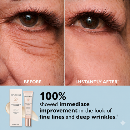 REPAIRSKINS Instant Face Temporary Tightener – Instant visible results in 60 seconds