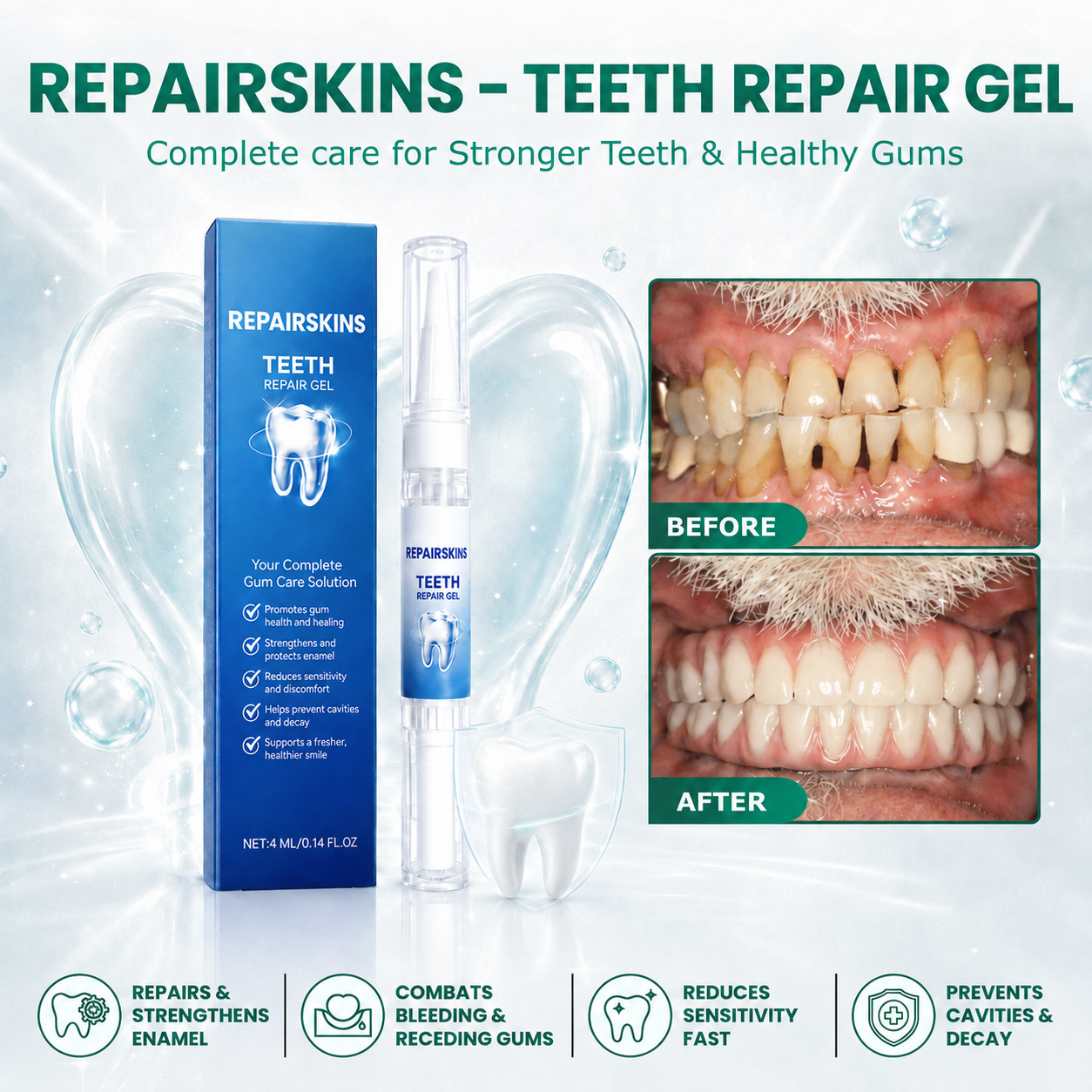 REPAIRSKINS - Teeth Repair Gel