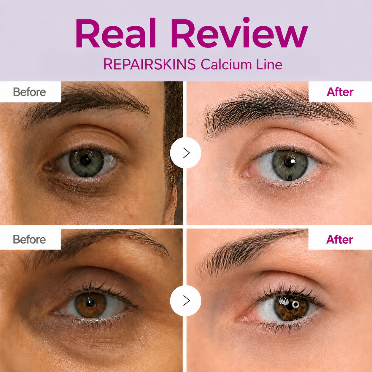 REPAIRSKINS Korean Calcium Dark Spot Eye Cream