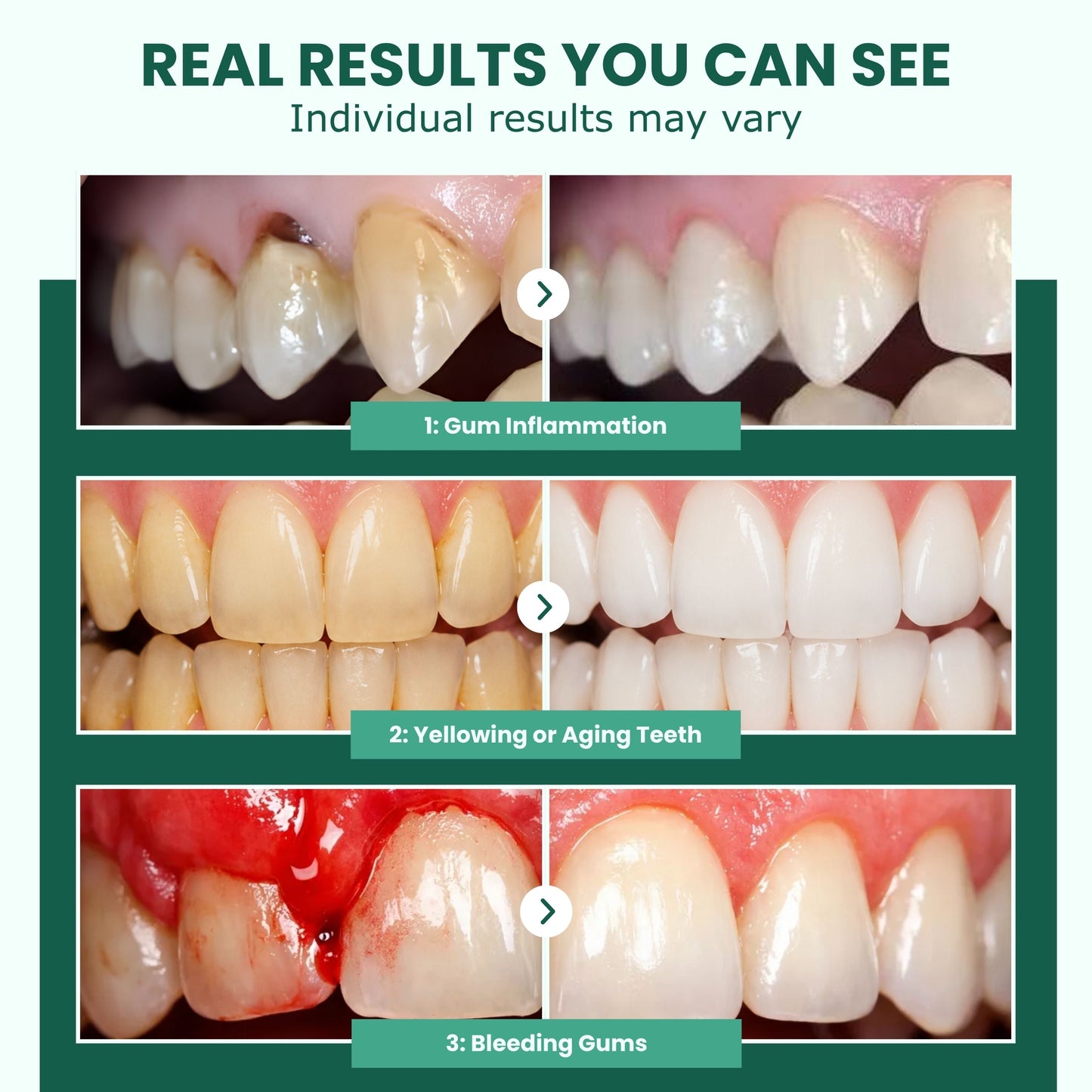 REPAIRSKINS - Teeth Repair Gel