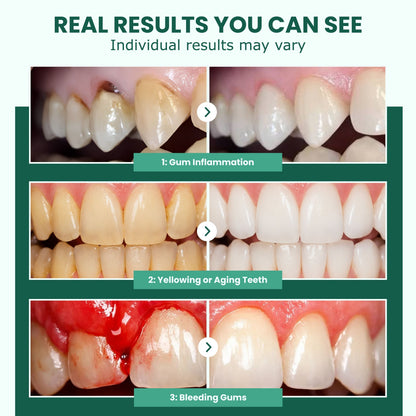 REPAIRSKINS - Teeth Repair Gel